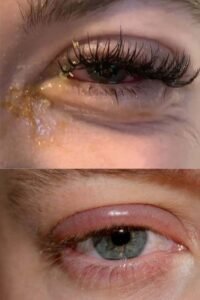 آیا اکستنشن مژه به مژه های طبیعی آسیب می رساند؟